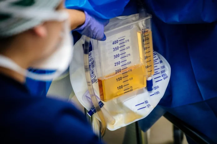 rinones-orina-cerdo-humano